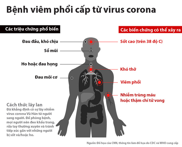 Bệnh viêm phổi cấp do virus corona